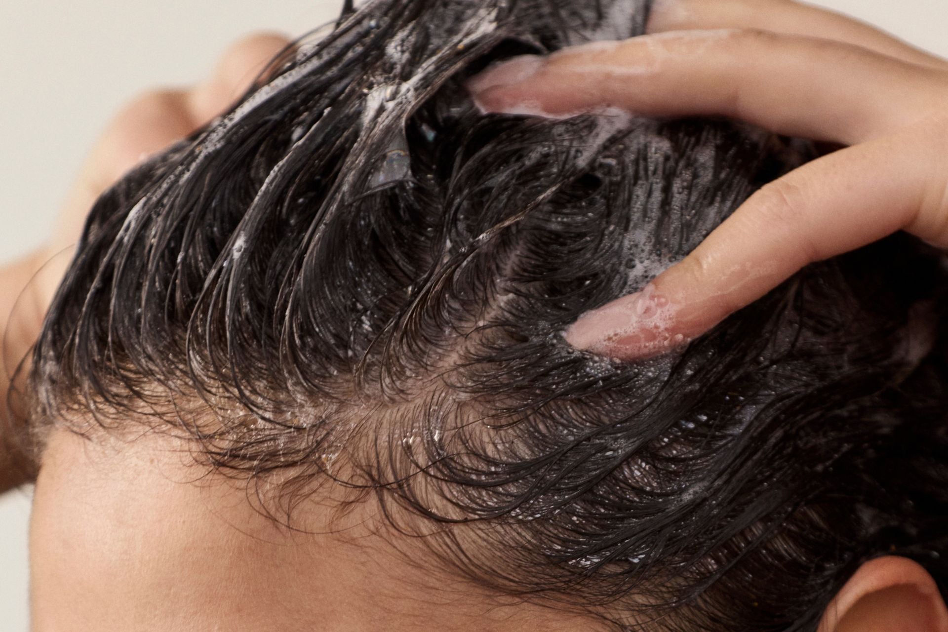 Is Ginger Shampoo Good for Dandruff? The Facts