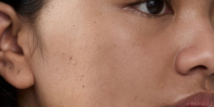 skincare routine oily skin Sri Lanka
